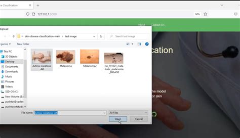 Image result for Skin Disease Detection Using MATLAB
