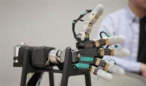 Image result for Bionic Arm Prosthetics