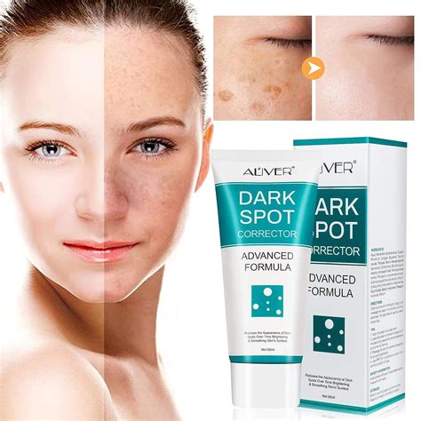 Dark Spot Corrector Cream for Face - Fade Black Precipitates, Remove ...