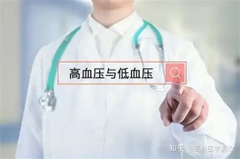 低压 的图像结果
