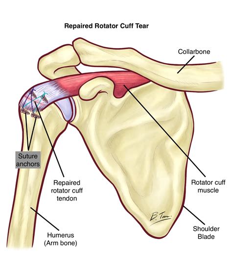 Shoulder Anatomy Rotator Cuff Rotator Cuff Tear St Albans, Stevenage