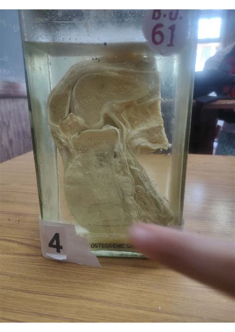 Patho specimens - MBBS (Bachelor of Medicine Bachelor of Surgery) - 4 ...