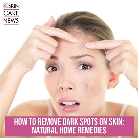 How To Remove Dark spots On Skin: Natural Home Remedies - Skin Care Top News