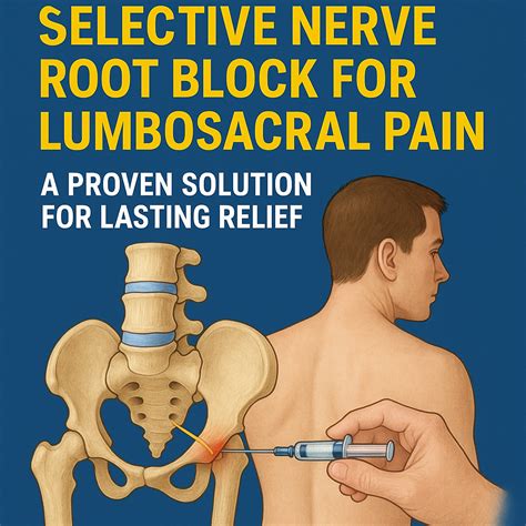 Image result for Selective Root Nerve Block Fluoroscopy