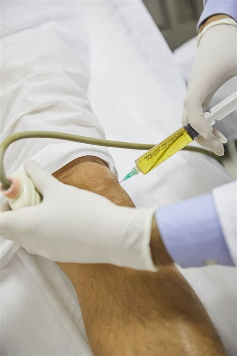 Stem Cell Injection 的图像结果