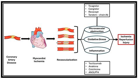 Myocardial Ischemia–Reperfusion Injury: Unraveling Pathophysiology ...