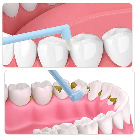 End Tuft Brush Dental at Seth Obrien blog