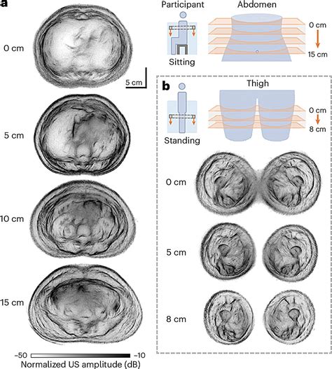 This New Ultrasound Technology Can Scan Your Entire Body in Seconds And ...
