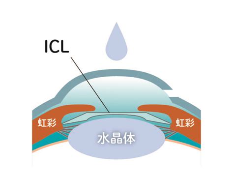 Recursion Formula Solver 的图像结果