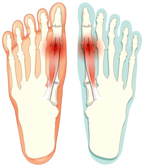 Foot Pain Doctor Near Me | Expert Foot Specialist in Hyderabad