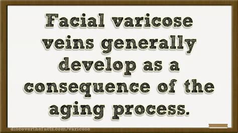 Facial Varicose Veins | ODP