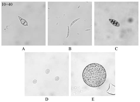 Automatic Detection of Rice Blast Fungus Spores by Deep Learning-Based ...