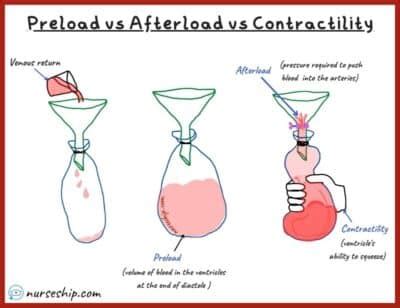 Image result for Preload and Afterload