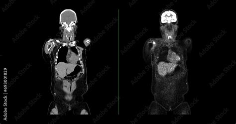 Image result for PET/CT Scan Risks