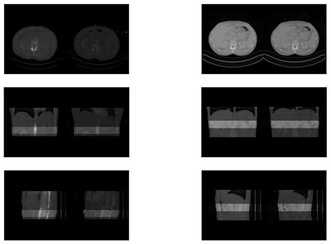 Generative Adversarial CT Volume Extrapolation for Robust Small-to ...