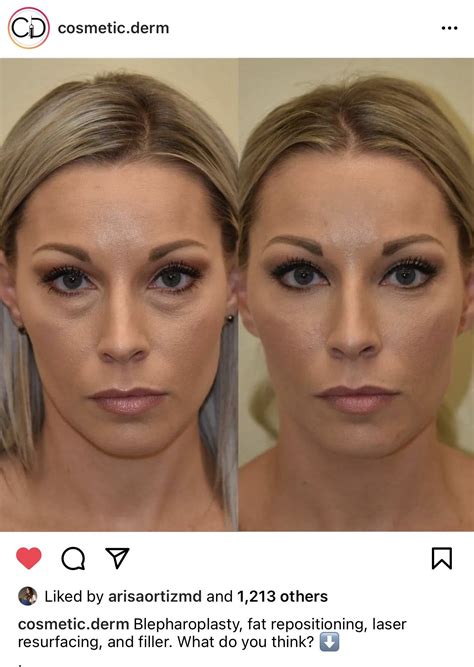 Pin by Sarah Willey on Nip and Tuck | Facial plastic surgery, Eye bag surgery, Cosmetic surgery