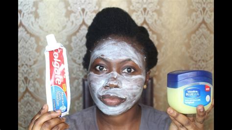 Toothpaste On Dark Spots 的图像结果