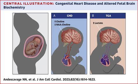 Magnetic Resonance Spectroscopy of Brain Metabolism in Fetuses With Congenital Heart Disease ...
