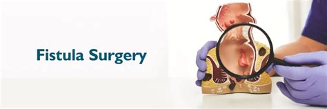 Optimal Exercise Timing for Lowering Colorectal Cancer Risk