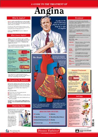 Diseases Explained: Angina Wall Chart : Lexi-Comp: Amazon.in: Books