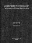 Buy Maxillofacial Rehabilitation: Prosthodontic and Surgical ...