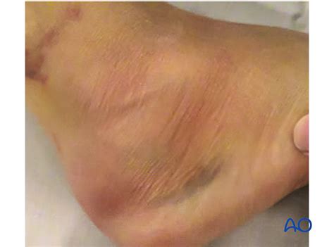 Hip Hop Dance Tutorial 的图像结果