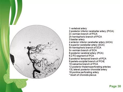 Digital subtraction angiography | PPTX