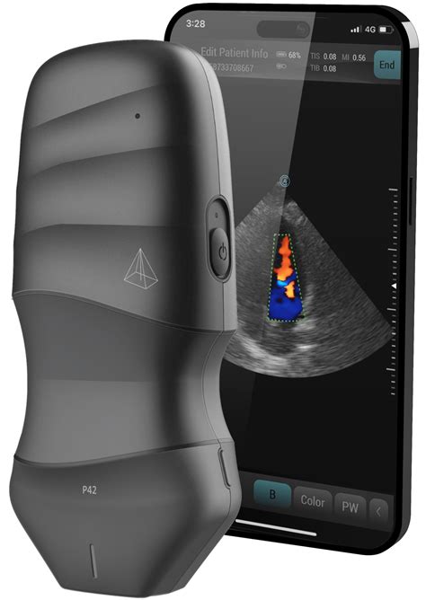Pocus 101 – Neo Medical USA Inc