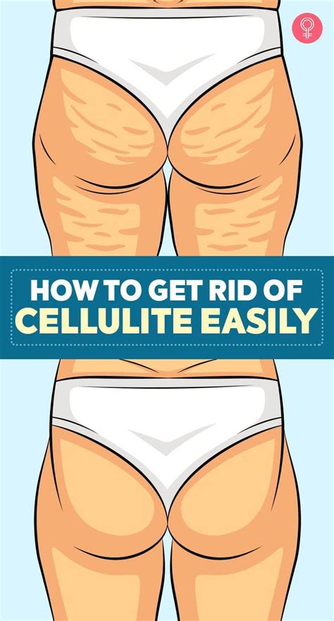 Image result for How to Remove Cellulite Fast
