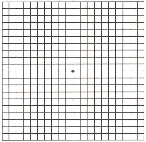 Grid Amsler Eye Test Macular Degeneration Armd Chart Print Printout ...