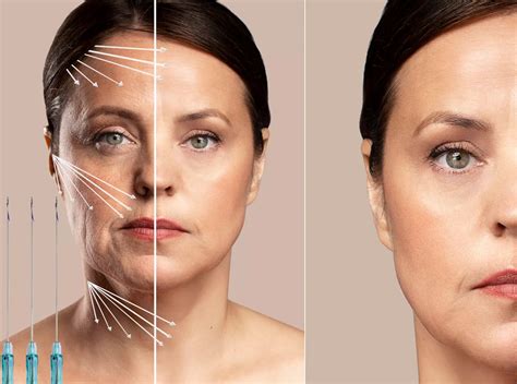 Dermabeauty Medical Spa - From $280 - Calabasas | Groupon