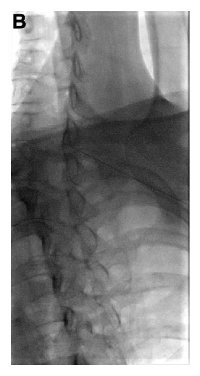 Image result for Contralateral Oblique View