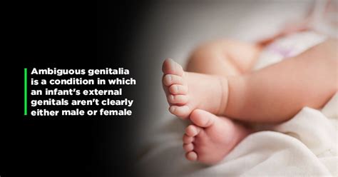 Man Abandons Hermaphrodite Baby In Odisha. Here's What This Rare ...