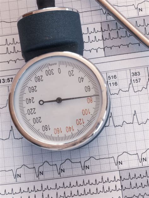 AFib Treatment : A Comprehensive Guide To Managing Atrial Fibrillation ...