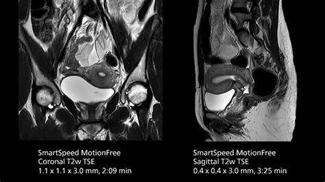 Faster MRIs at Mermaid Beach Radiology - Philips
