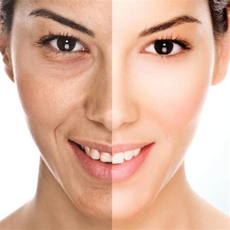 Advanced Exosome GFC Treatment For Skin Glow in Nagercoil