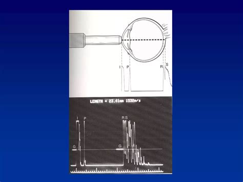 Image result for Understanding Biometry