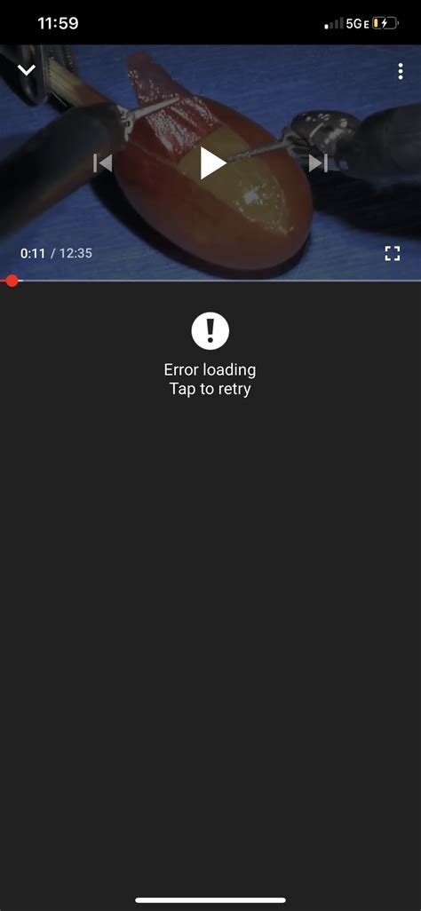 Loading Error Retry Fix 的图像结果
