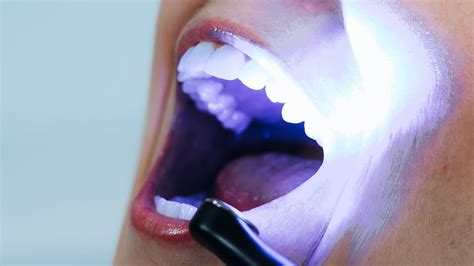 Cosmetic Dentistry | Infinity Dental Clinic Leeds | Natural Aesthetics