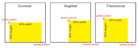 Real-Time Automated Segmentation and Classification of Calcaneal ...