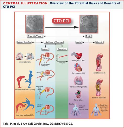 Chronic Total Occlusion (CTO) — Golden Shutter Films