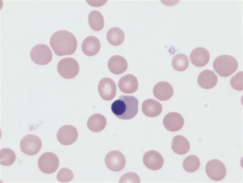 Nucleated Red Blood Cells