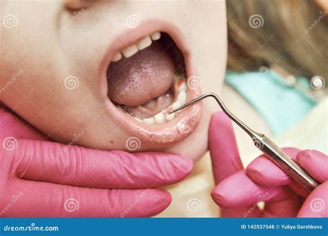 Image result for First Loose Tooth Getting Pulled Out