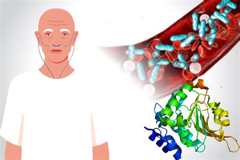 Procalcitonin utilization in Cancer patients with Sepsis – The Health Quest