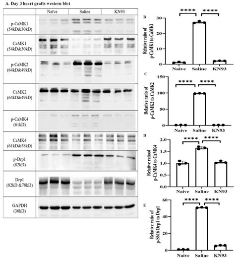The CaMK Family Differentially Promotes Necroptosis and Mouse Cardiac ...