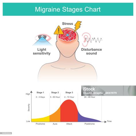 Migraines Stages Chart Migraines Stages Chart And A Factors Cause Of ...