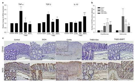 Therapeutic Potential of BMP7 in the Treatment of Osteoporosis Caused ...