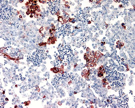 HSV Simplex 2 的图像结果