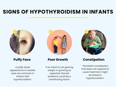 Recognizing Hypothyroidism in Youngsters Key Signs in Infants and ...