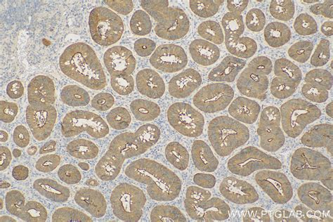 Harmonin antibody (11358-1-AP) | Proteintech